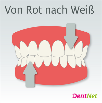 Vollprothese mit Ober- und Unterkiefer vor hellem Hintergrund