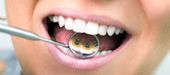 DentNet Ratgeber - Die linguale Zahnspange