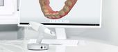 Digitale Zahnabformung: Präzision mit dem Intraoralscanner