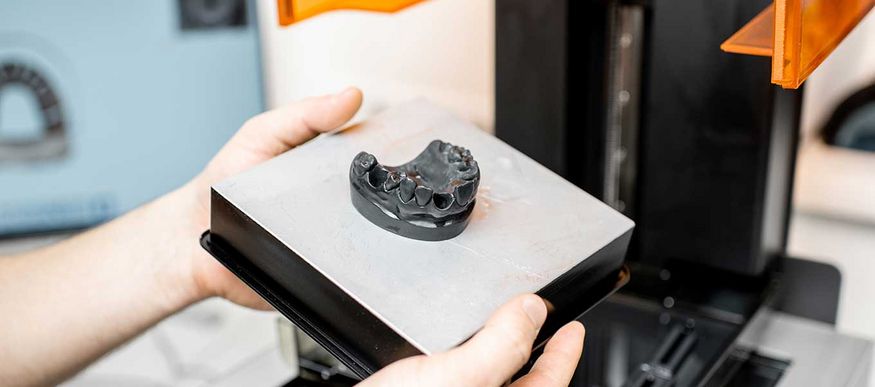 3D-gedrucktes Zahnmodell auf der Hand