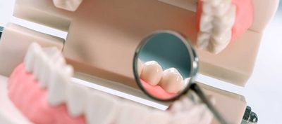 DentNet Ratgeber - Zahnversiegelung mit Microkristallen - Der Dentcoat