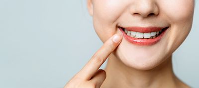 Dentnet-Ratgeber CHX-Chip
