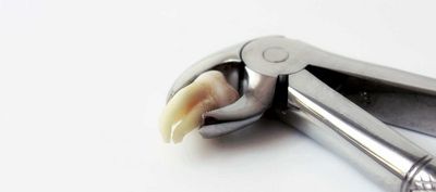 Alveolitis sicca: Ursachen, Symptome & Behandlung