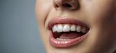 Gesundes Lächeln – IKK classic Zahnleistungen im DentNet