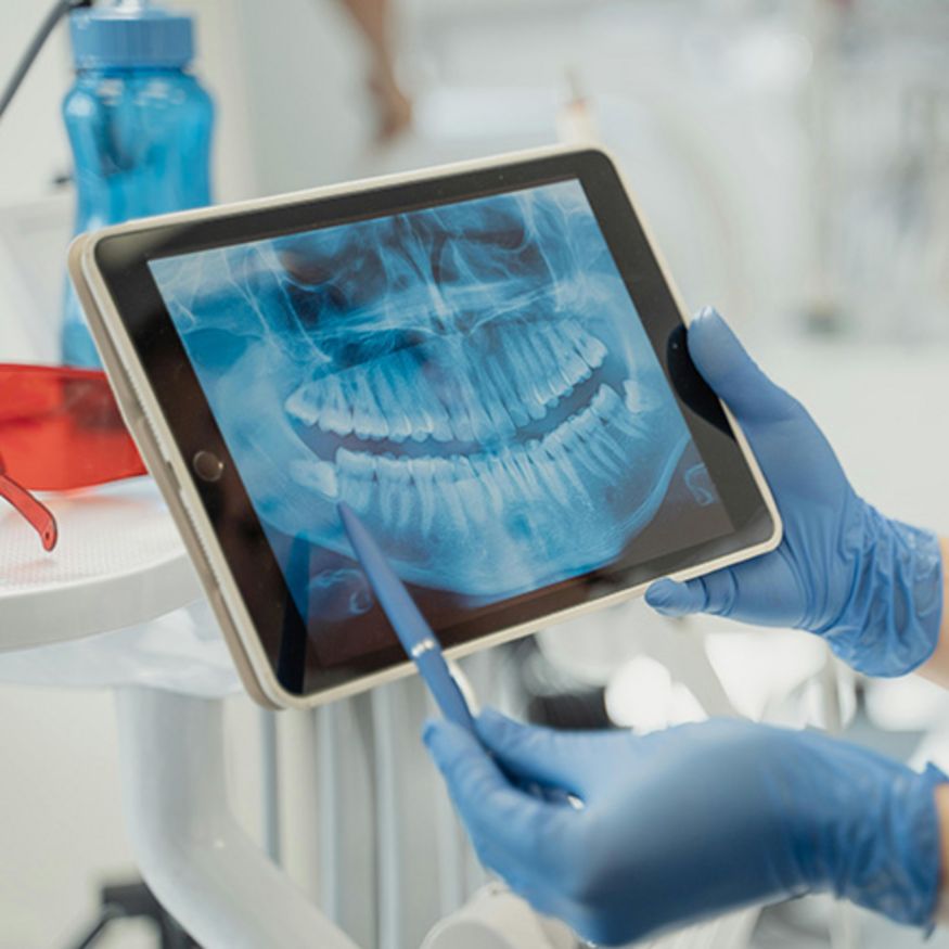Röntgenbild der Zähne auf einem Tablet
