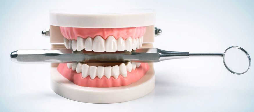 DentNet Ratgeber - Kreuzbiss - häufige Zahnfehlstellung