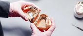 Hände halten eine Zahnprothese – Prothese richtig reinigen