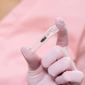 Was ist ein Implantat?