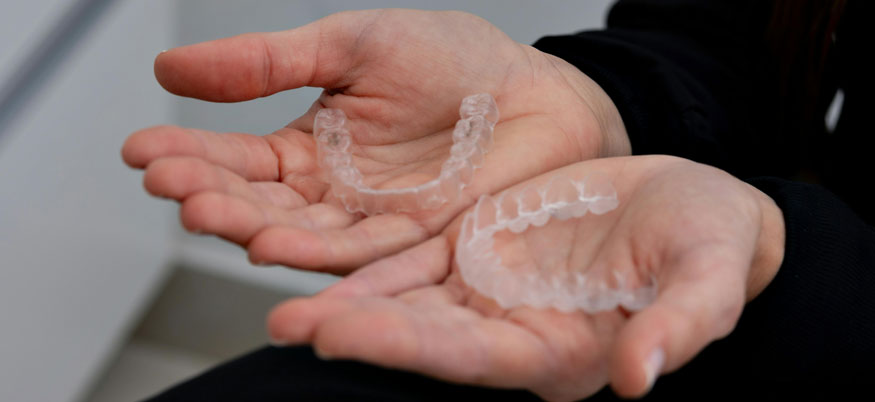 Zahnspange für Erwachsene: Gründe, Arten, Kosten und Tipps