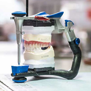 Was ist ein Dentallabor?