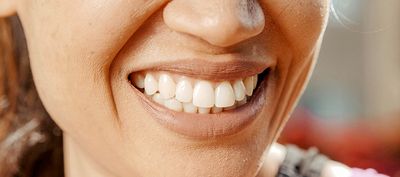 Digitale Zahnabformung: Präzision mit dem Intraoralscanner