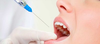 Die Spritze beim Zahnarzt - der Garant für eine schmerzfreie Behandlung