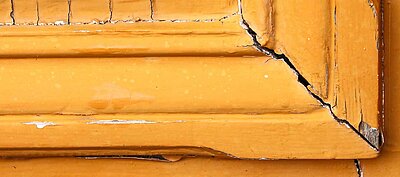 DentNet Ratgeber - Eingerissene Mundwinkel – was hilft bei Rhagaden?