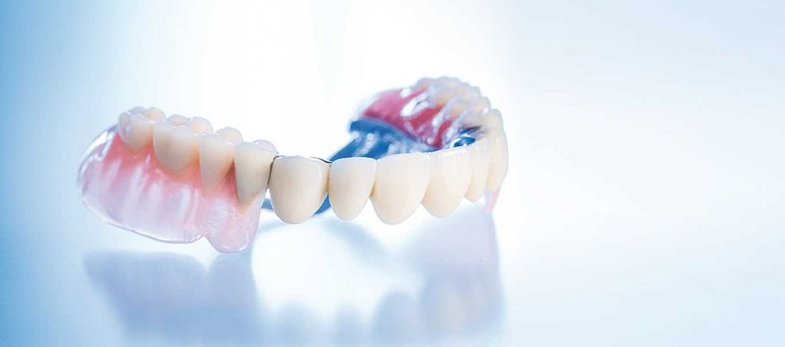 Herausnehmbarer Zahnersatz – flexibel und kostenbewusst