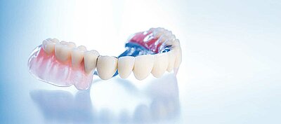 DentNet Ratgeber - herausnehmbarer Zahnersatz