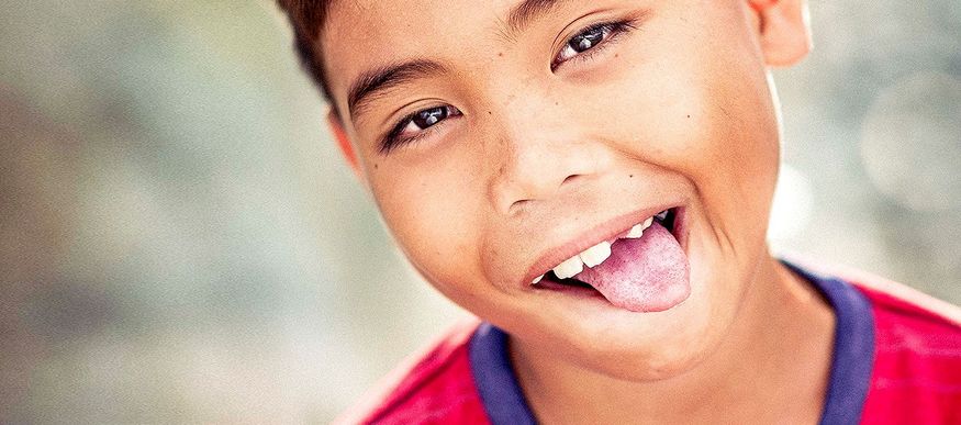 DentNet Ratgeber - Zahntrauma, Zahn abgebrochen DentNet Ratgeber - Zahntrauma, Zahn abgebrochen