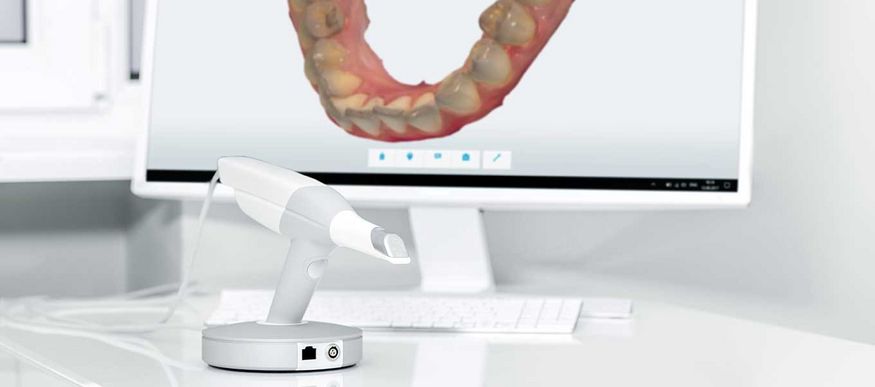 DentNet Ratgeber - Intraoralscanner - digitale Abformungen DentNet Ratgeber - Intraoralscanner - digitale Abformungen