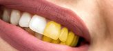 Was hilft gegen gelbe Zähne und wie entstehen Zahnverfärbungen?