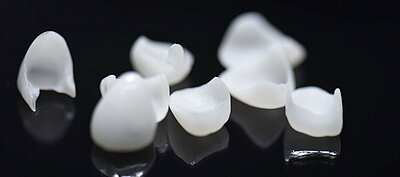 DentNet Ratgber - Ästhetische Zahnheilkunde DentNet Ratgber - Ästhetische Zahnheilkunde