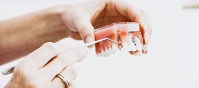 Implantate: Notwendigkeit, Risiken und Kosten