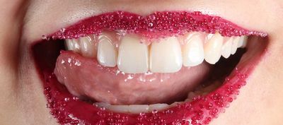 DentNet Ratgeber - Bläschen im Mund DentNet Ratgeber - Bläschen im Mund