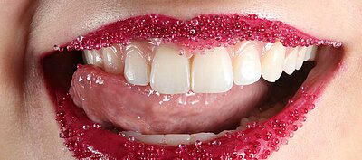 DentNet Ratgeber - Bläschen im Mund DentNet Ratgeber - Bläschen im Mund