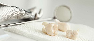 DentNet Ratgeber - Probleme mit den Weisheitszähnen?