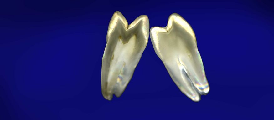 DentNet Ratgeber - Forensische Zahnmedizin