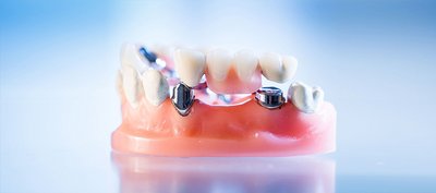Zahnschmerzen Was Tun Schnelle Hilfe
