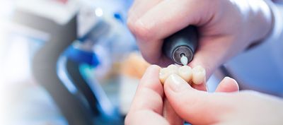Zahnbrücken: Arten, Materialien und Kosten im Überblick