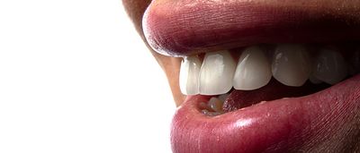 Interimsprothese: Übergangsprothese für Zahnverlust – Funktionen und Vorteile