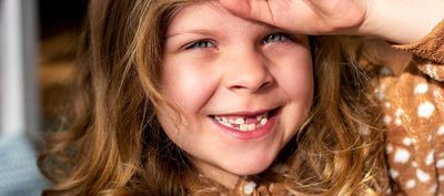 DentNet Ratgeber - Zahnlücken, fehlende Zähne