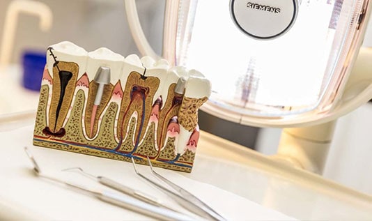 Zahnarztpraxis Peter Rupp in Gießen - Wurzelkanalbehandlung
