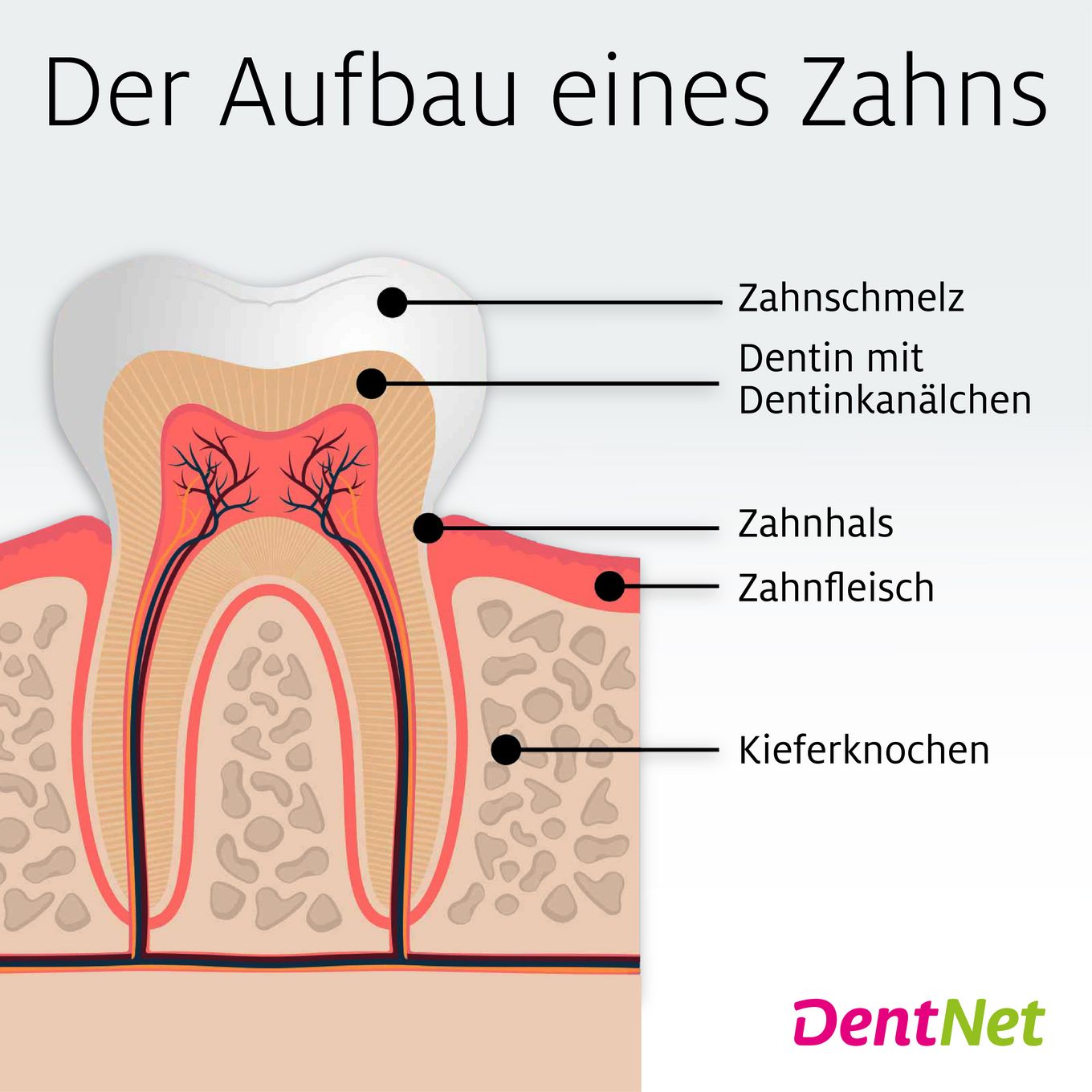 Zahnhalsversiegelung