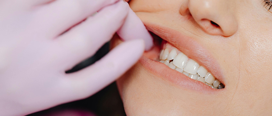 Zahnfleischentzündung (Gingivitis): Ursachen, Symptome und Behandlung