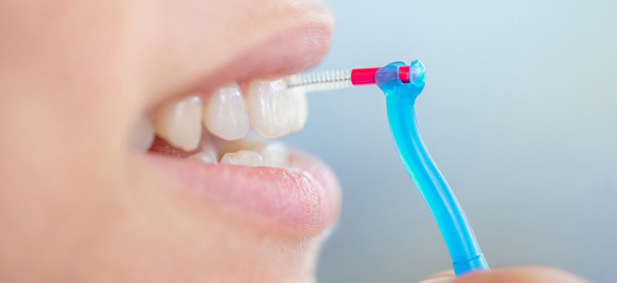 Interdentalbürsten