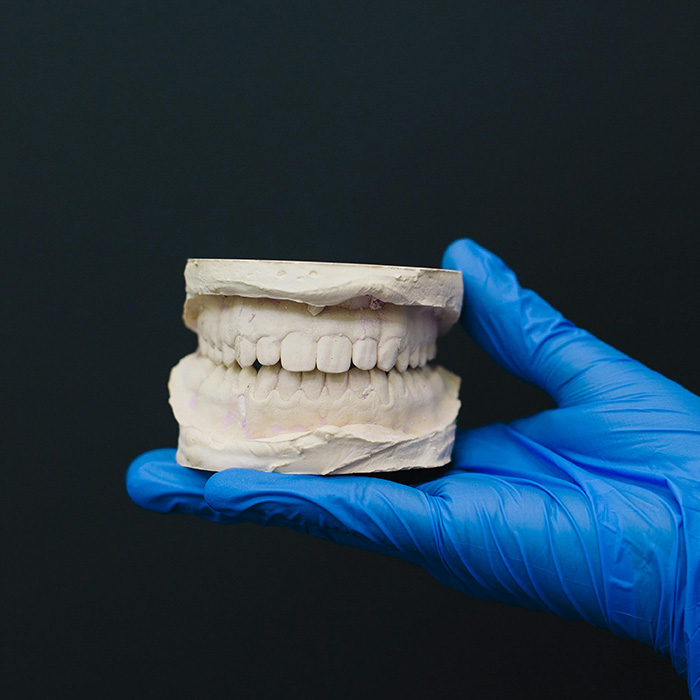DentNet, Zahn, Zähne, locker, Parodontitis