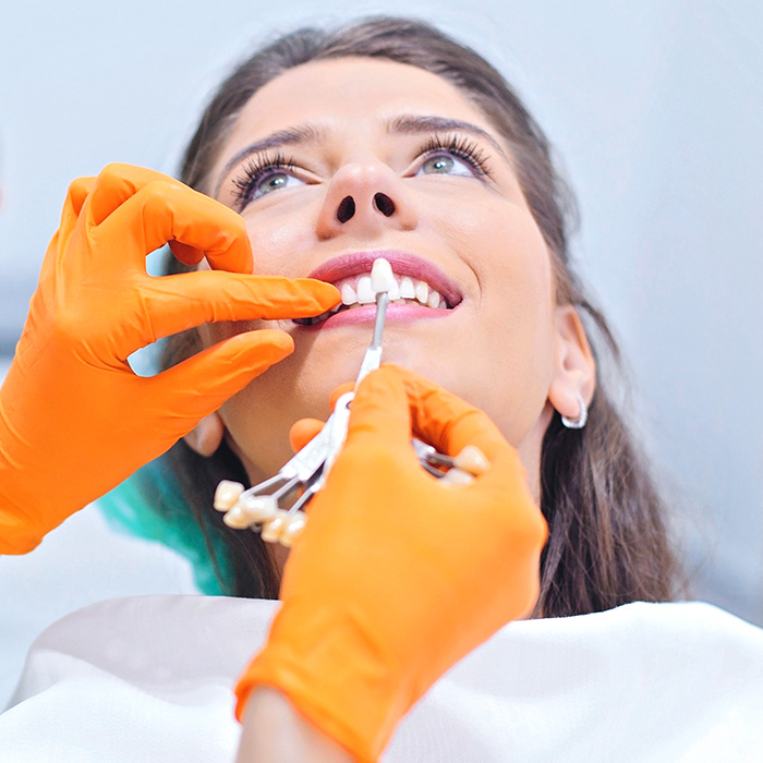 DentNet, Zahnverblendung, Dentalfurnier, Ästhetische Zahnheilkunde Zahnaufherllung