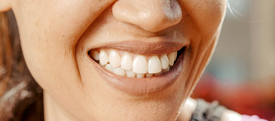 Digitale Zahnabformung: Präzision mit dem Intraoralscanner