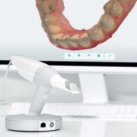 Intraoralscanner