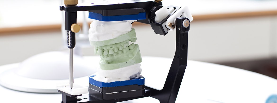 DentNet Ratgeber - Zahnersatz im Zahntechniklabor