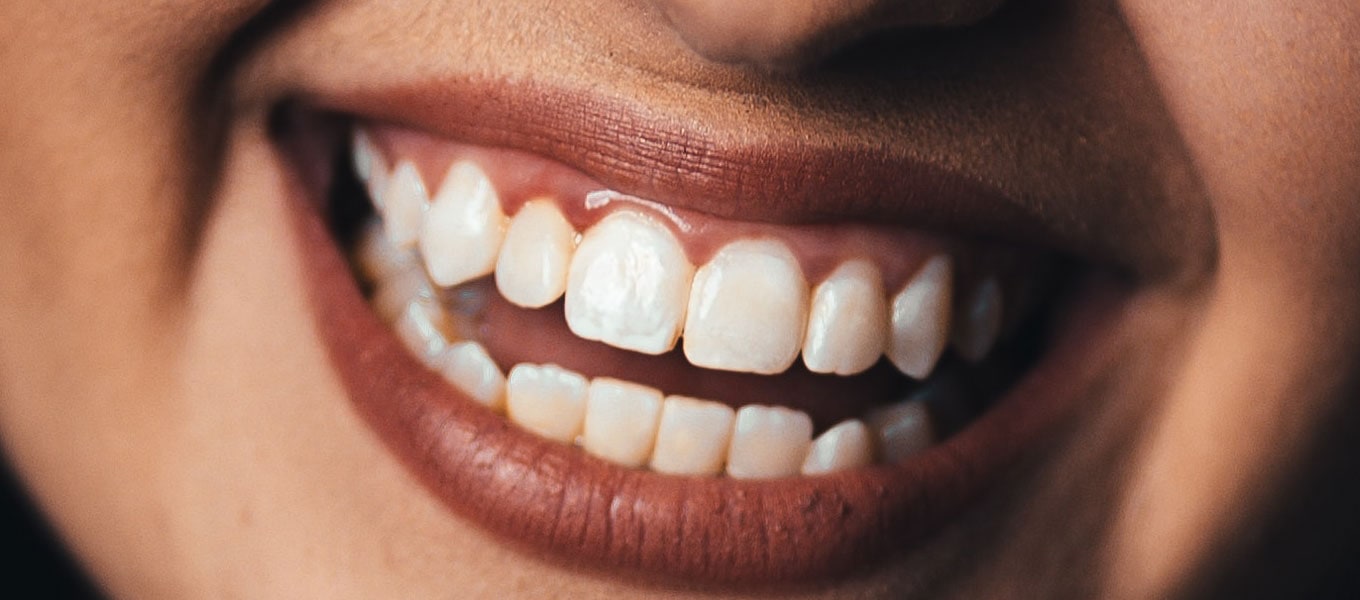 DentNet - Ratgeber - 30 Fakten über Zähne DentNet - Ratgeber - 30 Fakten über Zähne
