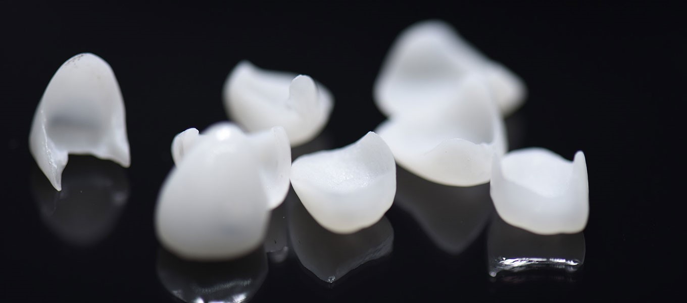 DentNet Ratgber - Ästhetische Zahnheilkunde