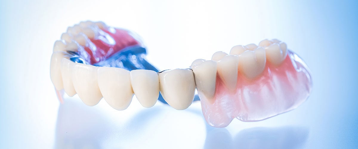 Gaumenplatte zahnprothese ohne Eine Zahnprothese