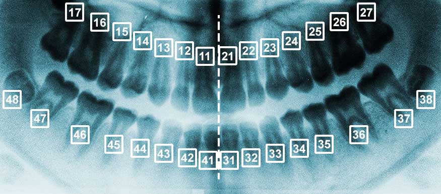 DentNet Ratgber - Zahnkreuz DentNet Ratgber - Zahnkreuz