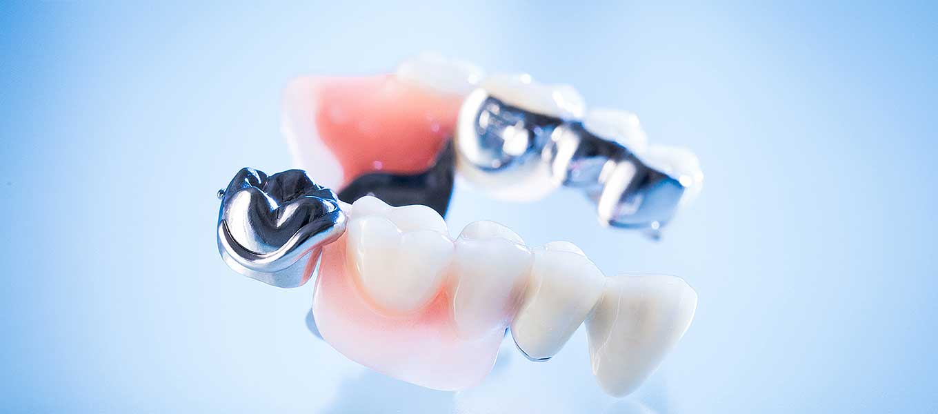 Nachts tragen zahnprothese Zahnersatzprothesen: Gewöhnung