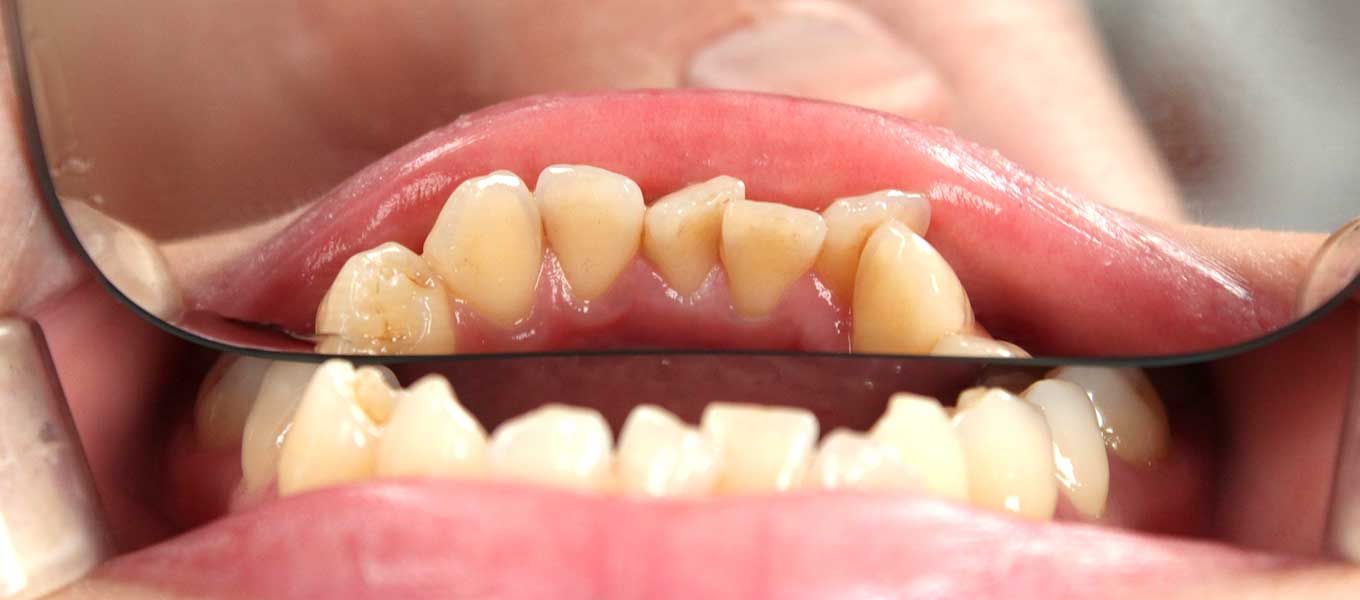 DentNet Ratgeber - Funktionsdiagnostik beim Zahnarzt 2
