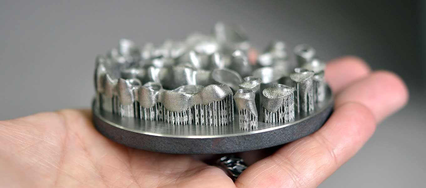 DentNet Ratgeber - Zähne aus dem 3D-Drucker – Digitalisierung in der Zahnmedizin DentNet Ratgeber - Zähne aus dem 3D-Drucker – Digitalisierung in der Zahnmedizin