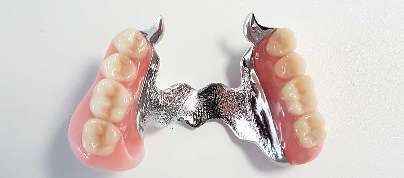 DentNet Ratgeber – Geschiebeprothese
