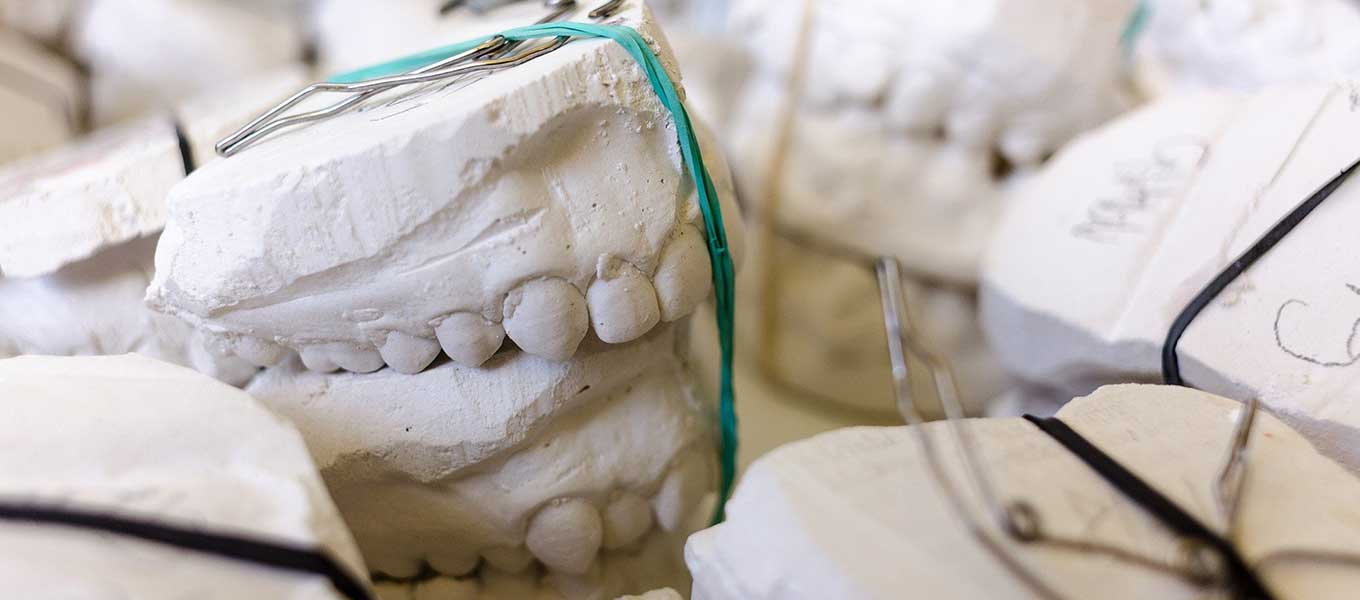 DentNet Ratgeber – Gebissabformung und Zahnabdruck